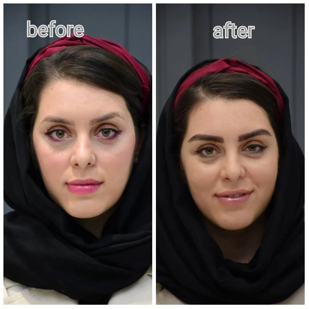 نمونه کار کاشت ابرو مشهد